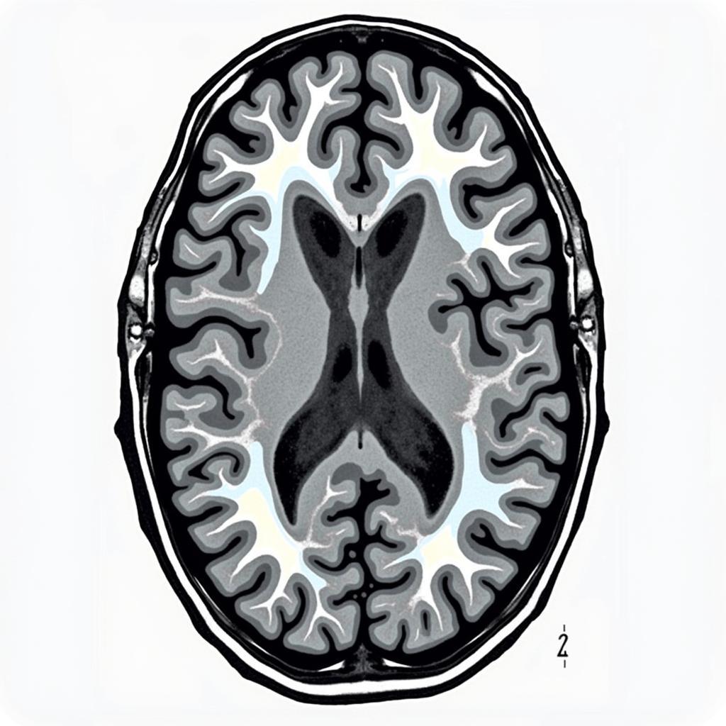 Brain Scan Showing Impact of Car Accident